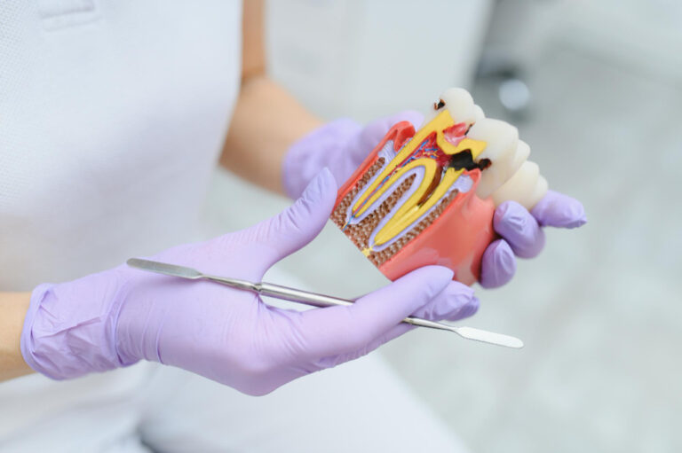 root canal treatment