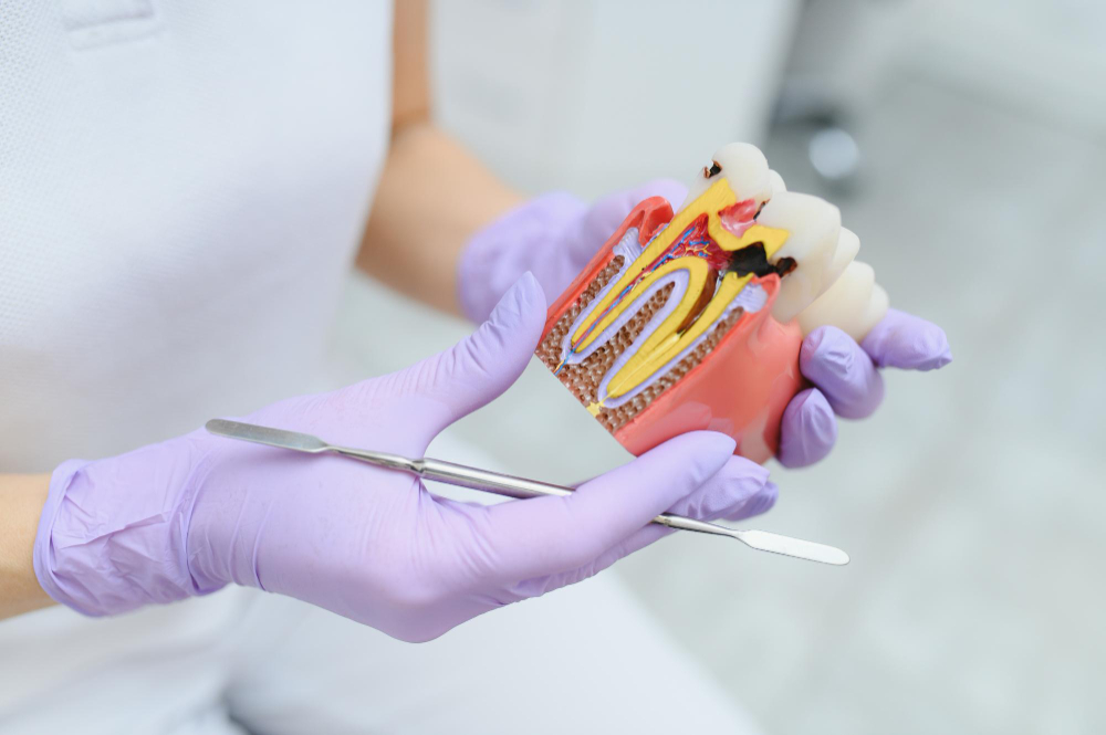 root canal treatment